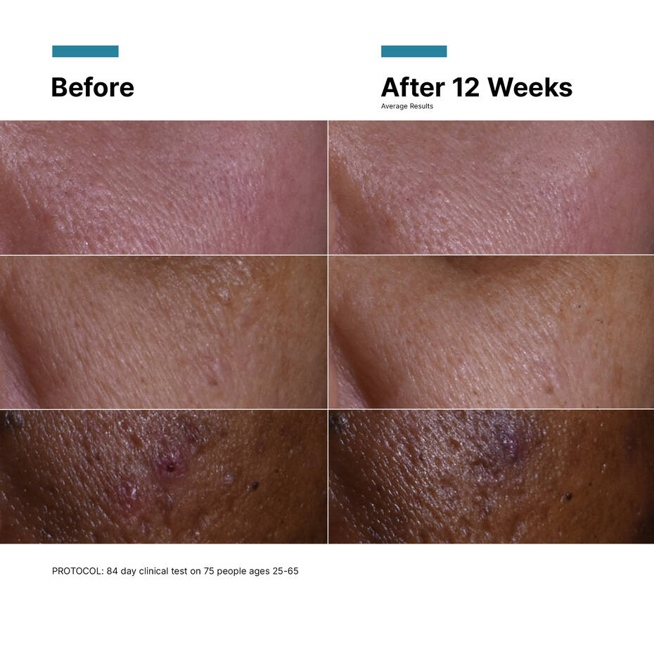 C E Ferulic® with 15% L-Ascorbic Acid
