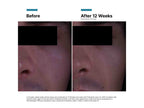 P-TIOX Anti-Wrinkle Cream