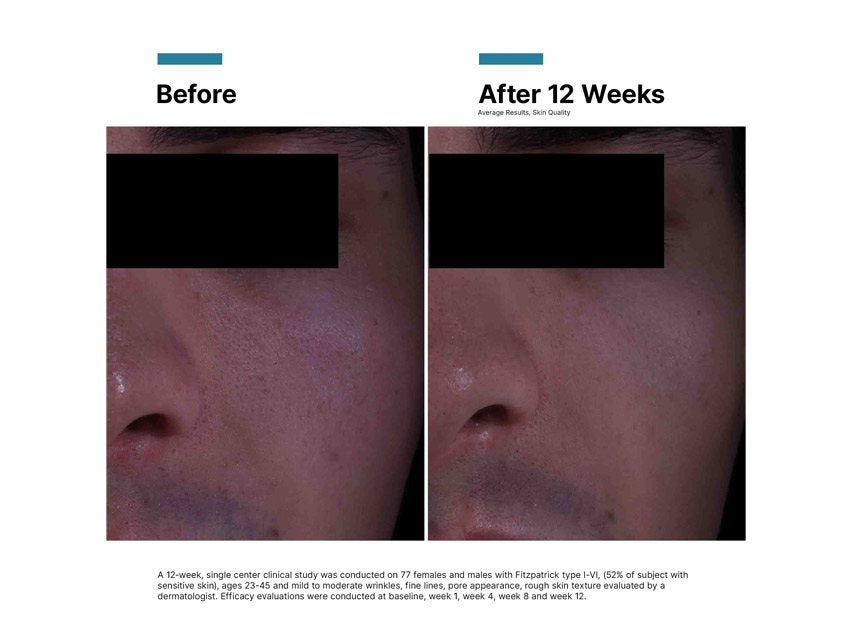 P-TIOX Anti-Wrinkle Cream
