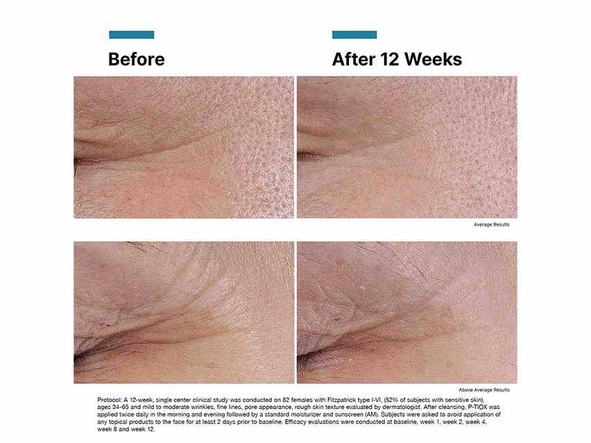 P-TIOX Anti-Wrinkle Serum