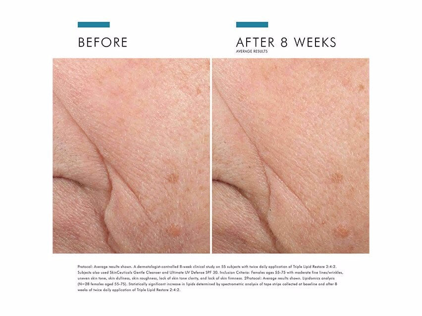 Triple Lipid Restore 2:4:2