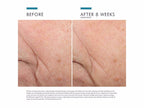 Triple Lipid Restore 2:4:2